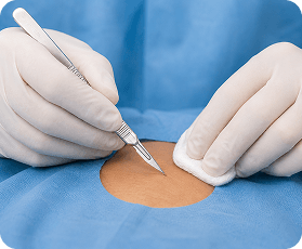 Minor Surgery Packs